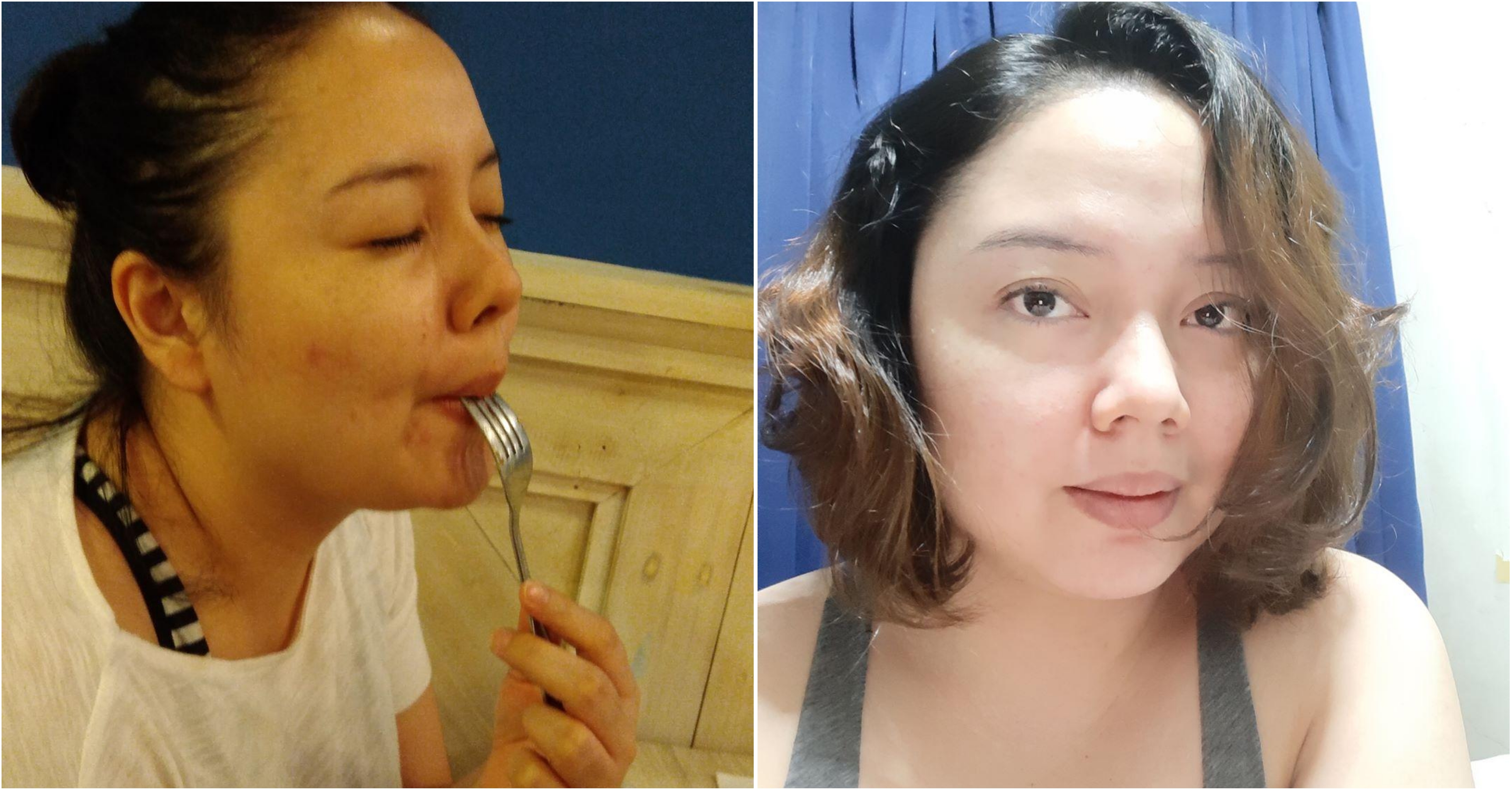 @honeysuiza_trước và sau da mụn
