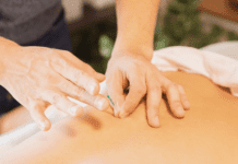 Tiêu điểm về châm cứu: Có thể giúp giảm lo âu không? Spotlight on Acupuncture