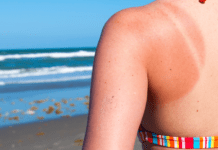 Best After-Sun Products To Help Soothe Sunburnt Skin
